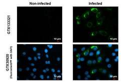 Anti-Zika virus NS4B protein antibody used in Immunocytochemistry/ Immunofluorescence (ICC/IF). GTX133321